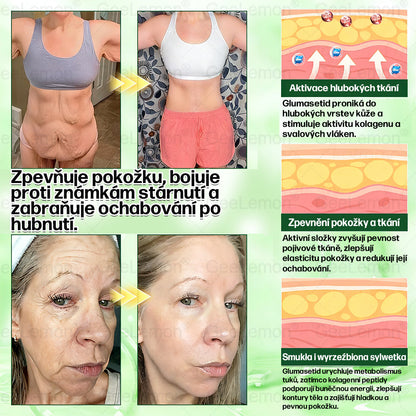 𝐆𝐞𝑒𝑙𝑒𝐦𝐨𝐧® 👩‍⚕️ Glum𝐚𝐬𝐞tide 8 v 1 – Zeštíhlující nano mikrojihlový náplas(Pouze jednou denně, viditelné změny již za 7 dní)  Určeno pro osoby s obezitou, diabetem, spánkovou apnoe.-js5142