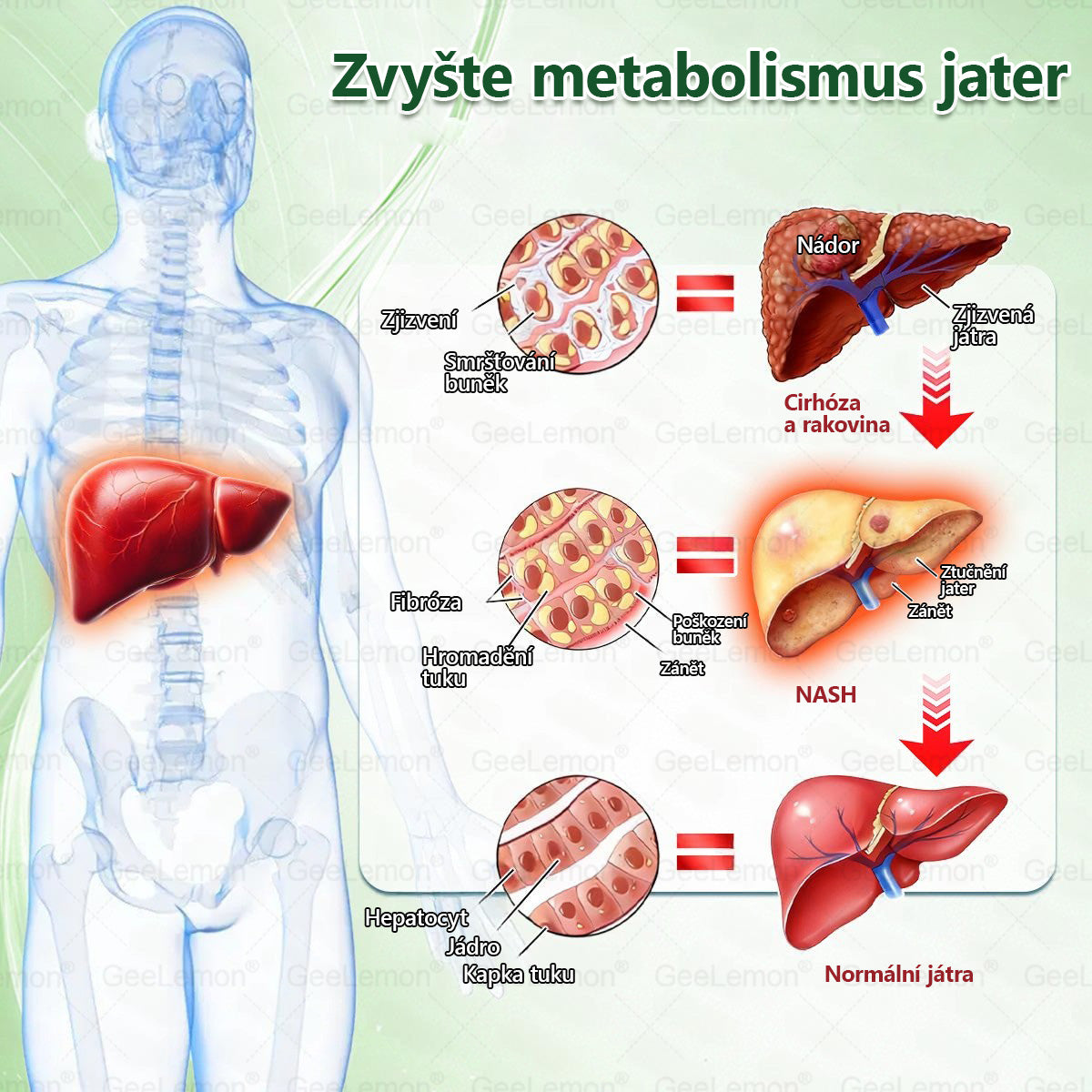 Oficiální český obchod | 👩‍⚕️ 𝐆𝐞𝐞𝐋𝐞𝐦𝐨𝐧® 8v1 Nanomikrojehlicové náplasti na formování těla 🇨🇿 Pouze 1 použití denně ✅ Výsledky viditelné již za 7 dní – vhodné pro obezitu, kardiovaskulární zdraví, cukrovku a problémy s klouby.
