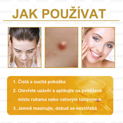 𝖠𝖯𝖪𝖠𝖯𝖪® 🐝 Krém s včelím jedem na obnovu pokožky 🐝 pomáhá při řešení kožních problémů, jako jsou: vrásky, jizvy, pigmentové skvrny, strie, akné, lupénka, ekzém, kožní léze, podráždění, záněty a další kožní potíže.