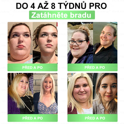 Oficiální český obchod | 👩‍⚕️ 𝐆𝐞𝐞𝐋𝐞𝐦𝐨𝐧® 8v1 Nanomikrojehlicové náplasti na formování těla 🇨🇿 Pouze 1 použití denně ✅ Výsledky viditelné již za 7 dní – vhodné pro obezitu, kardiovaskulární zdraví, cukrovku a problémy s klouby.