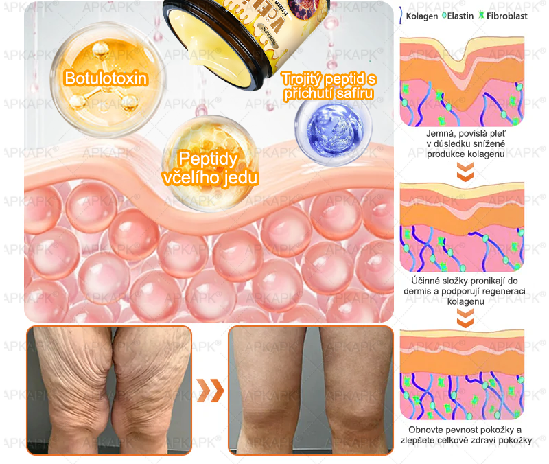 𝖠𝖯𝖪𝖠𝖯𝖪® 🐝 Krém s včelím jedem na obnovu pokožky 🐝 pomáhá při řešení kožních problémů, jako jsou: vrásky, jizvy, pigmentové skvrny, strie, akné, lupénka, ekzém, kožní léze, podráždění, záněty a další kožní potíže.