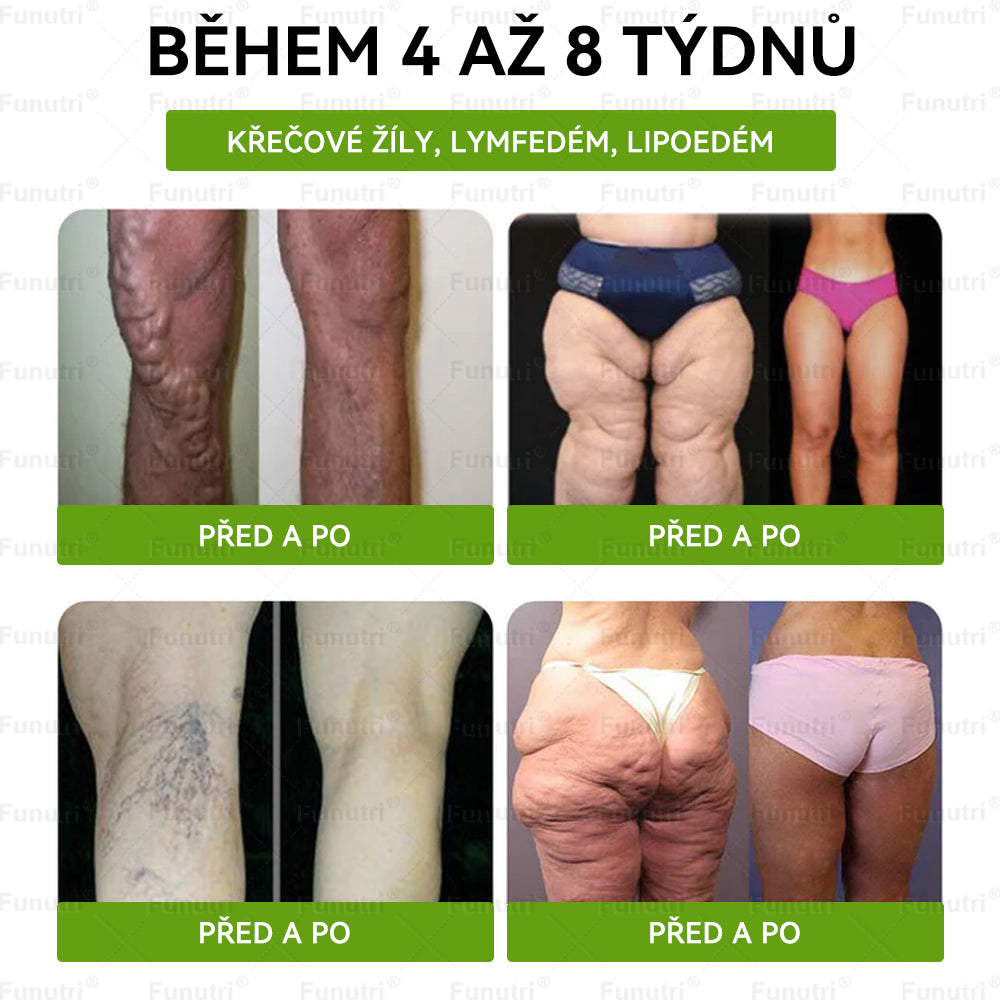 Oficiální obchod pro ČR • Funutri® 10 v 1 nano mikrojehličková náplast pro podporu metabolismu