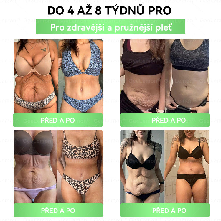 Oficiální český obchod | 👩‍⚕️ 𝐆𝐞𝐞𝐋𝐞𝐦𝐨𝐧® 8v1 Nanomikrojehlicové náplasti na formování těla 🇨🇿 Pouze 1 použití denně ✅ Výsledky viditelné již za 7 dní – vhodné pro obezitu, kardiovaskulární zdraví, cukrovku a problémy s klouby.