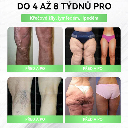 Oficiální český obchod | 👩‍⚕️ 𝐆𝐞𝐞𝐋𝐞𝐦𝐨𝐧® 8v1 Nanomikrojehlicové náplasti na formování těla 🇨🇿 Pouze 1 použití denně ✅ Výsledky viditelné již za 7 dní – vhodné pro obezitu, kardiovaskulární zdraví, cukrovku a problémy s klouby.