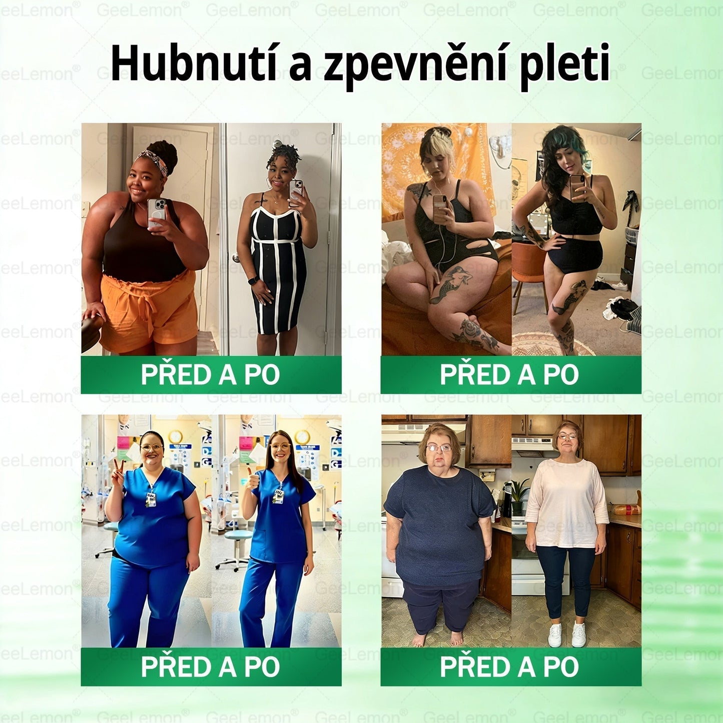 𝐆𝐞𝑒𝑙𝑒𝐦𝐨𝐧® 👩‍⚕️ Glum𝐚𝐬𝐞tide 8 v 1 – Zeštíhlující nano mikrojihlový náplas(Pouze jednou denně, viditelné změny již za 7 dní)  Určeno pro osoby s obezitou, diabetem, spánkovou apnoe.-js5142