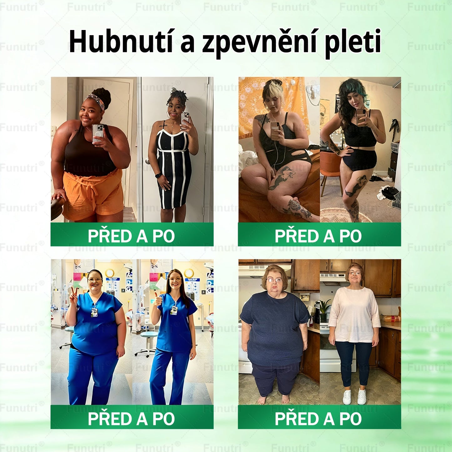 Oficiální obchod pro ČR • Funutri® 10 v 1 nano mikrojehličková náplast pro podporu metabolismu