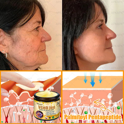 𝖠𝖯𝖪𝖠𝖯𝖪® 🐝 Krém s včelím jedem na obnovu pokožky 🐝 pomáhá při řešení kožních problémů, jako jsou: vrásky, jizvy, pigmentové skvrny, strie, akné, lupénka, ekzém, kožní léze, podráždění, záněty a další kožní potíže.