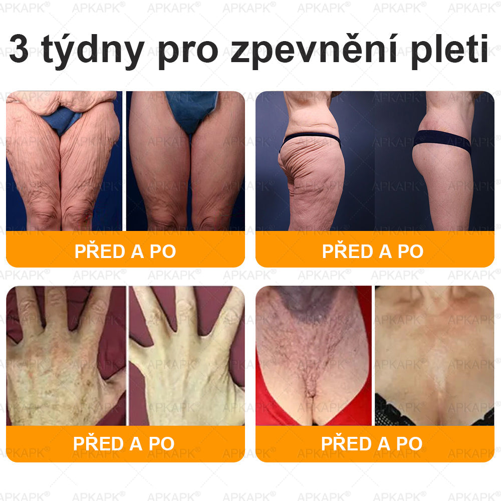 𝖠𝖯𝖪𝖠𝖯𝖪® 🐝 Krém s včelím jedem na obnovu pokožky 🐝 pomáhá při řešení kožních problémů, jako jsou: vrásky, jizvy, pigmentové skvrny, strie, akné, lupénka, ekzém, kožní léze, podráždění, záněty a další kožní potíže.