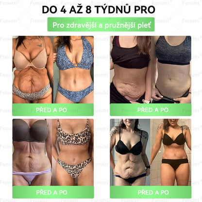 Oficiální obchod pro ČR • Funutri® 10 v 1 nano mikrojehličková náplast pro podporu metabolismu